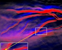 OU Health Sciences Tests Revolutionary Imaging Technique for Pancreatic Cancer